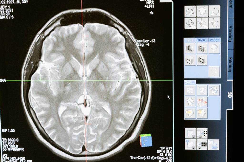 medical image of a brain